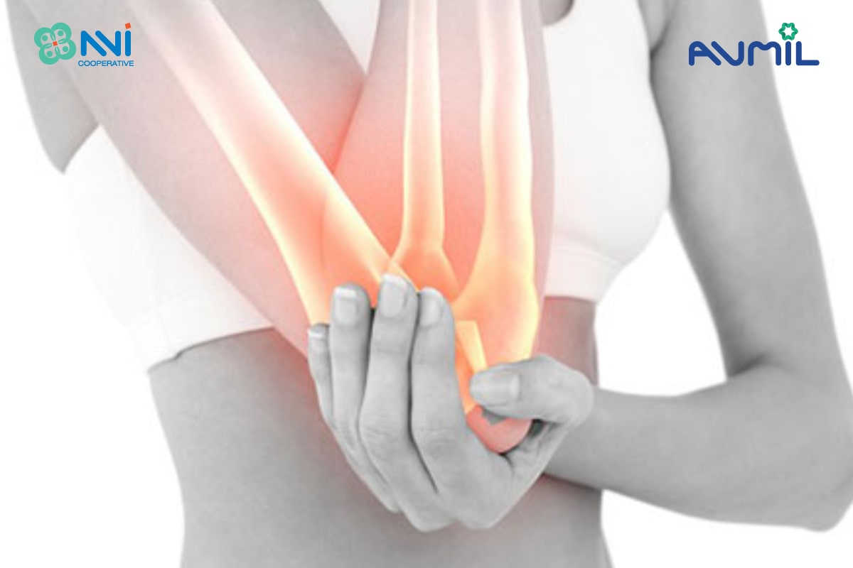 Cháo ấu tẩu hỗ trợ giảm đau, chống viêm tốt